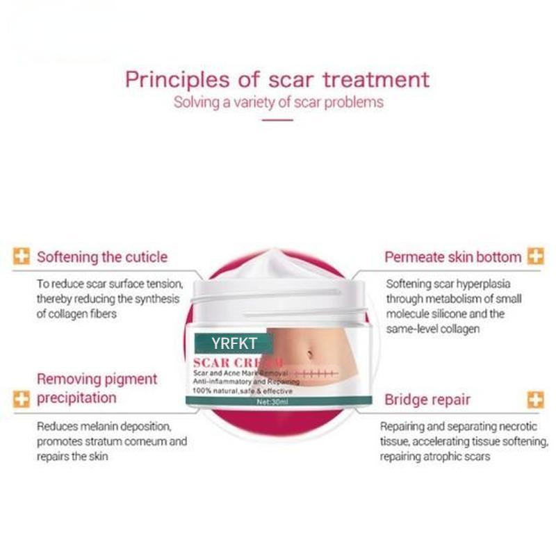 Krém pro péči o pleť po akné na jizvách hluboce proniká do kutikuly