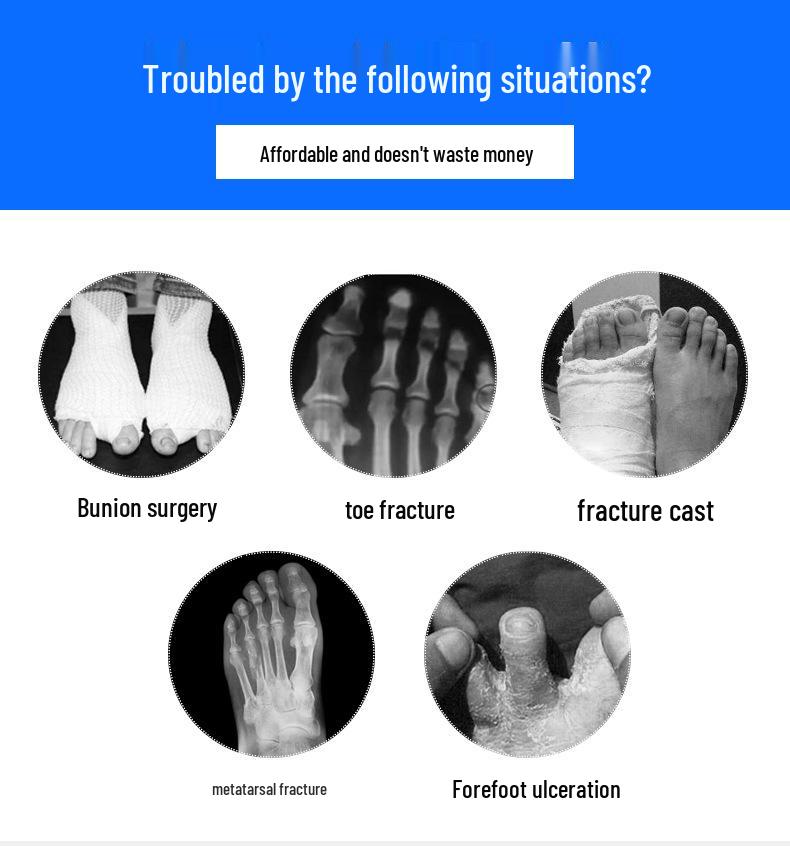 Forefoot Pressure Relief Shoes for Postoperative Foot Injury and Hallux Fracture Recovery
