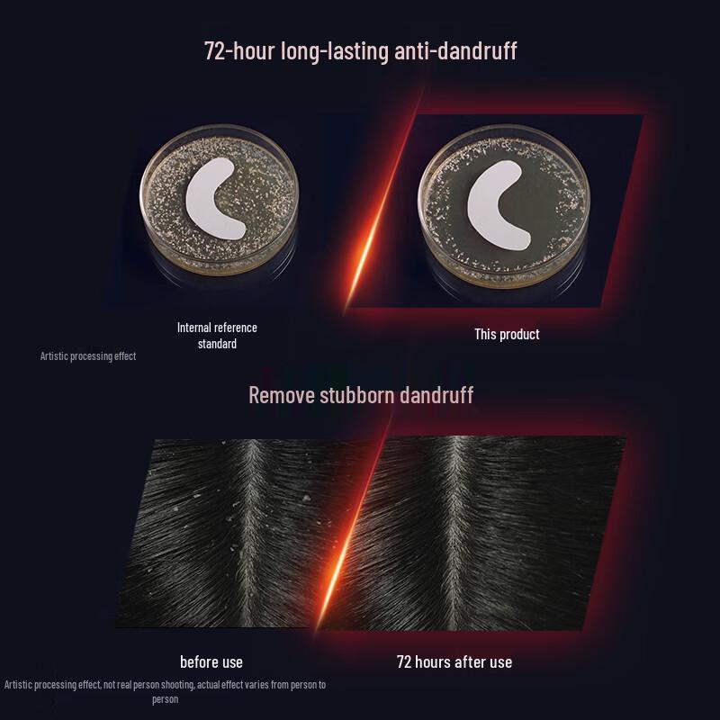 CLEAR Men Anti-Dandruff Shampoo