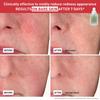 Erborian Centella Red Serum For Visible Redness 30 Ml