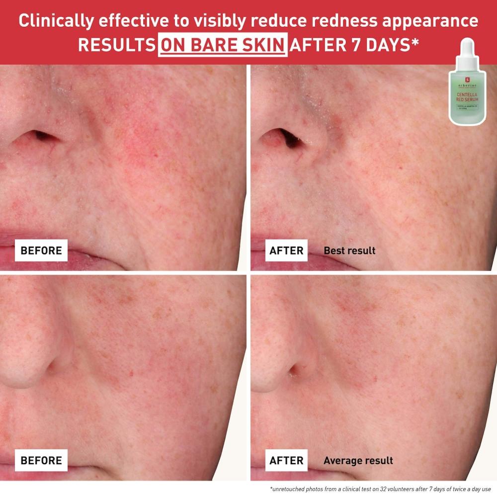 Erborian Centella Red Serum For Visible Redness 30 Ml