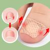 Nail Patch Ingrown Toenail Correction Nail Sticker Foot Pulling Patch Glue-Free Foot Sticker Nail Groove Ingrown Toenail Correction Nail Care Patches