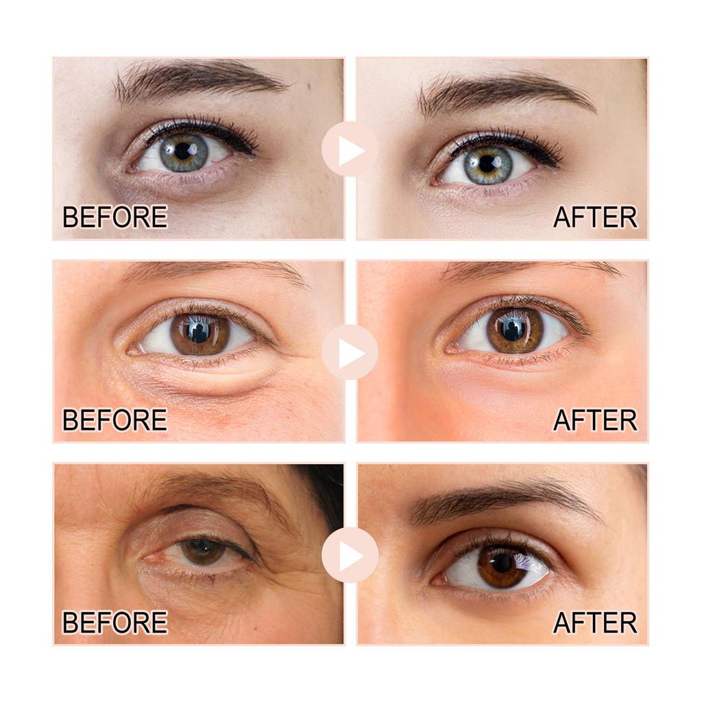 Hoygi Retinol Eye Cream 30g Hydrating Anti-wrinkle Formula For Dark Circles And Fine Lines