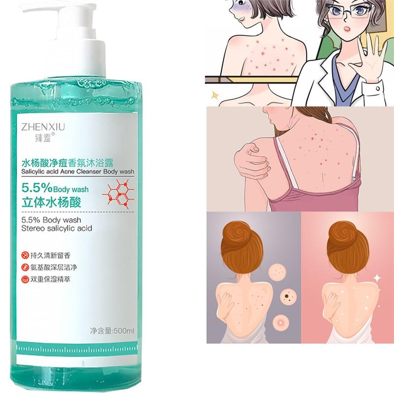 Sprchový gél s kyselinou salicylovou, Jemný a vyhladzujúci, Jemne exfoliačný, Denný sprchový gél na akné, Hĺbkovo čistí akné na chrbte a maz beige
