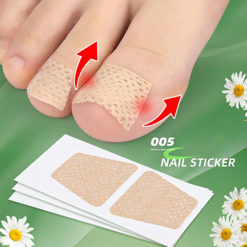 Nail Patch Ingrown Toenail Correction Nail Sticker Foot Pulling Patch Glue-Free Foot Sticker Nail Groove Ingrown Toenail Correction Nail Care Patches