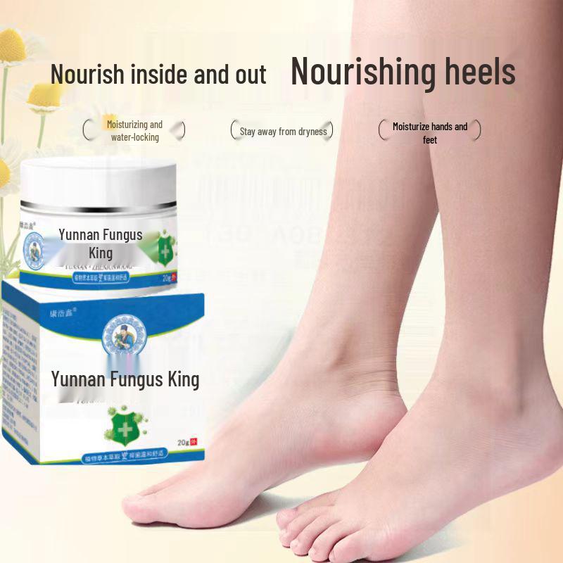 Genuine Yunnan Fungus King Heel & Hand Anti-Cracking Cream for Dry, Rough Skin