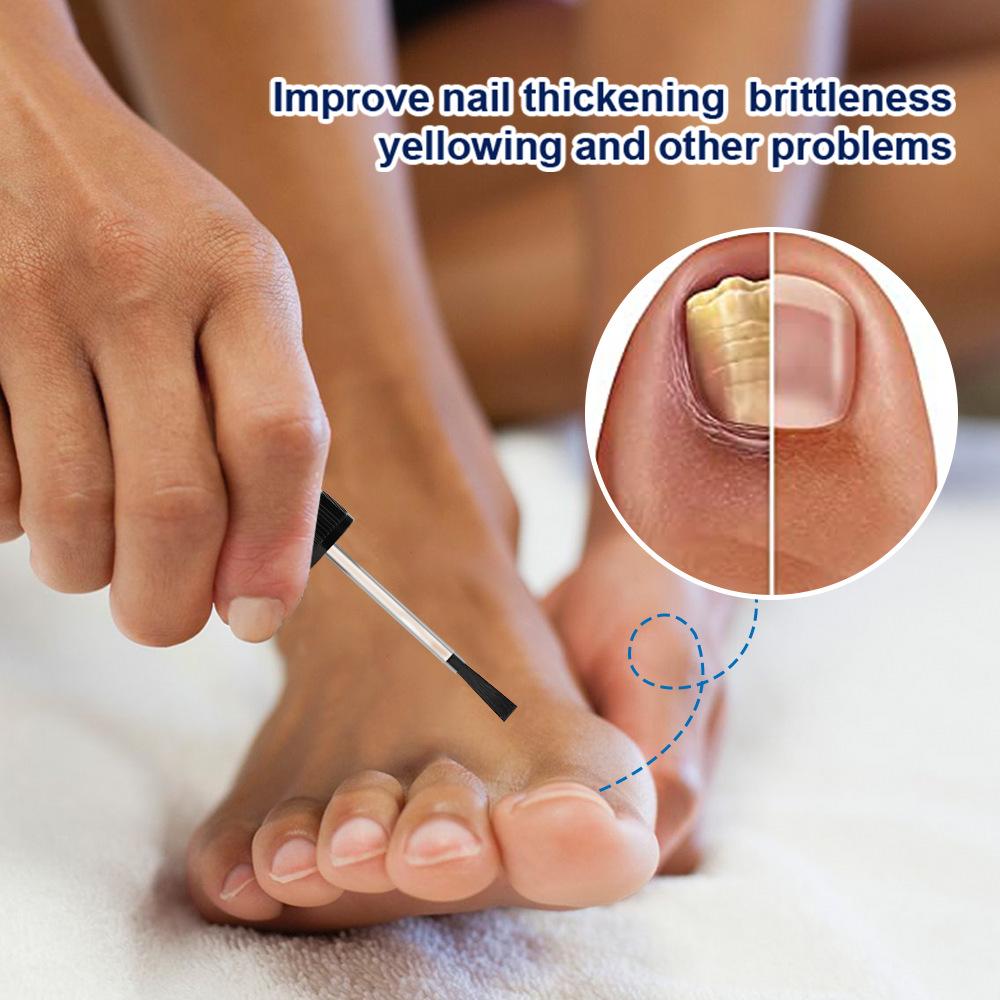 New Bright Potassium Care Liquid Onychomycosis Care Liquid New Bright Nails Onychomycosis Improves The Appearance Of Nails.20ML