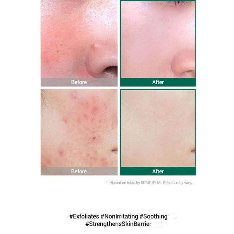 SOME BY MI AHA, BHA, PHA 30 Days Miracle Serum 50ml