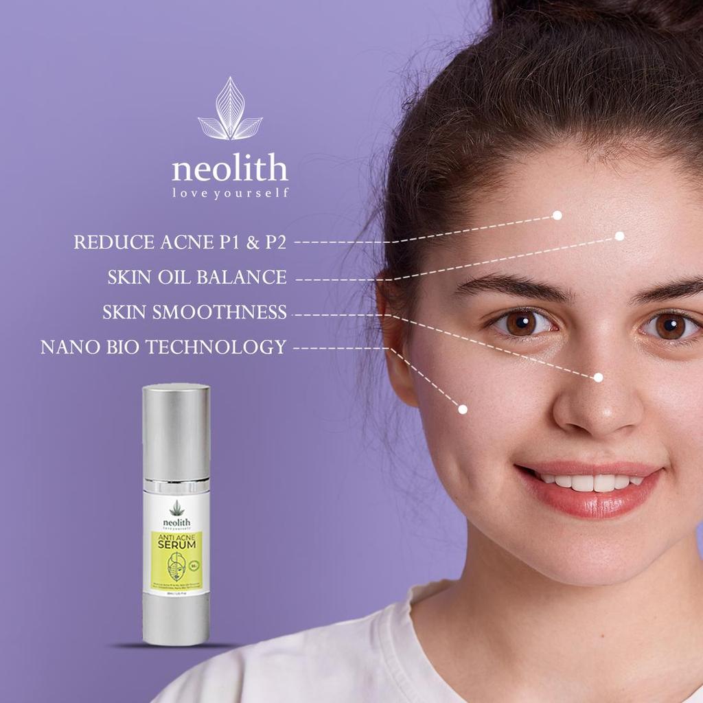 Neolith Anti-Akne-Serum – mit Ingwerwurzelextrakt, Traubenfruchtextrakt, Harzextrakt || 94 % biologisch || Ohne Parabene, Silikon und Mineralöl – 30 ml