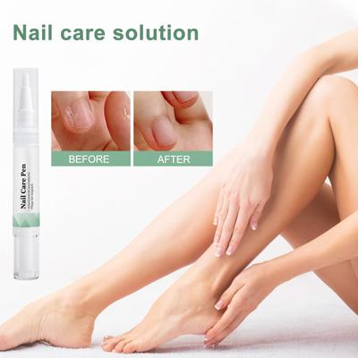 Nail TreatmentPen, Nagelriemolie, Beschadigde Nagelpen, Nagelversterkende NagelriemSwitch, AloëVera En TeaTree Olie Herstellen Beschadigd, 3ml