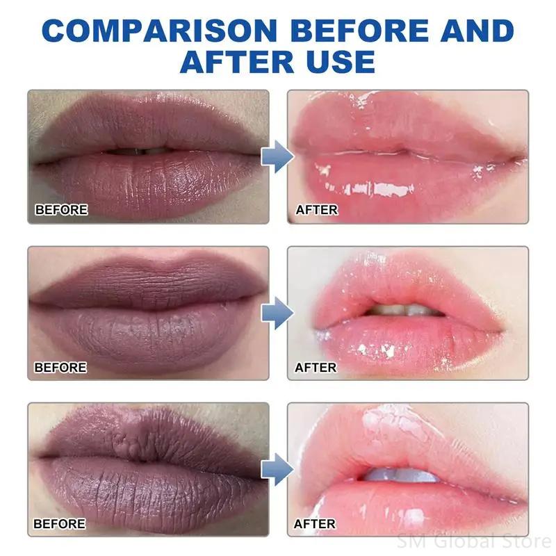 Entfernen Sie dunklen Lippenbalsam, hellen Sie Melanin auf, Lippenmaske, Peeling, mildern Sie Lippenfältchen, abgestorbene Haut, feuchtigkeitsspendend, aufhellend, reparierend, Lippenpflegeprodukte