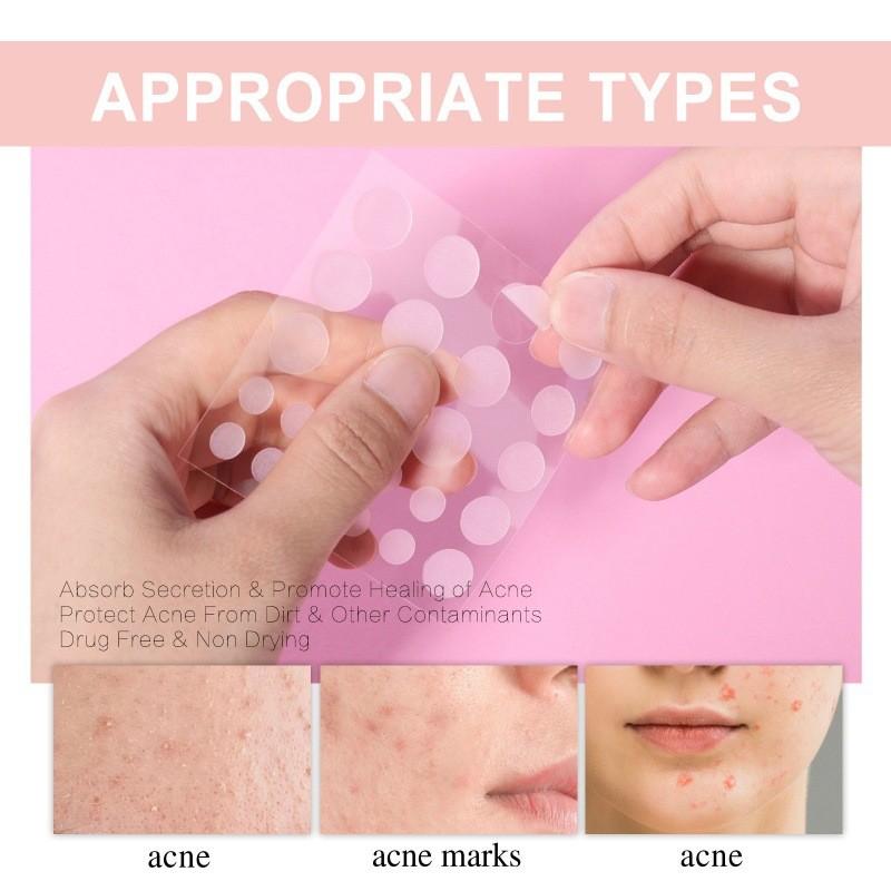 West Month Acne Patch Gentle Repair Invisible Breathable Skin Smoothing 72pcs