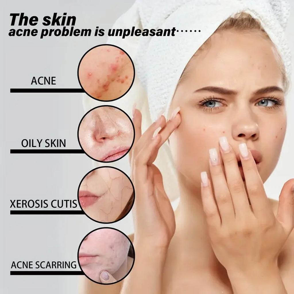 Blemish Serum Cream To Reduce Fine Lines, Smooth Wrinkles and Improve Damaged Skin