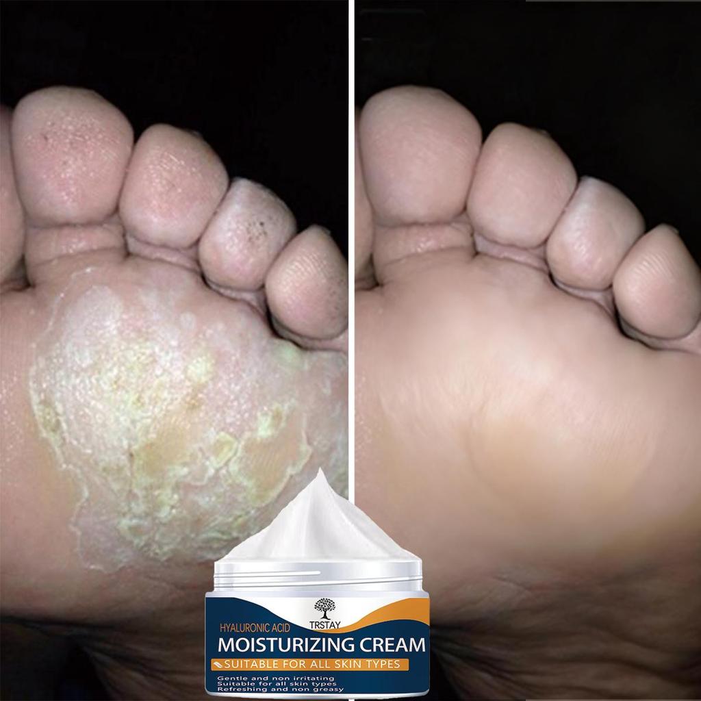 Maschera idratante per i piedi per una pelle morbida e liscia, con crema per i piedi per una cura extra