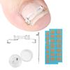 Ingrown Toenail Corrector Kit for Curved Nail Stainless Steel Armor Buckle Toe Nail Straightener Ingrown Nail Tool