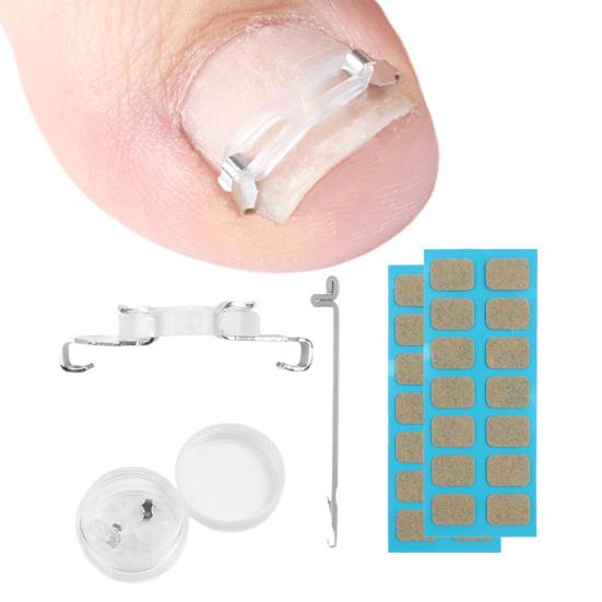Ingrown Toenail Corrector Kit for Curved Nail Stainless Steel Armor Buckle Toe Nail Straightener Ingrown Nail Tool