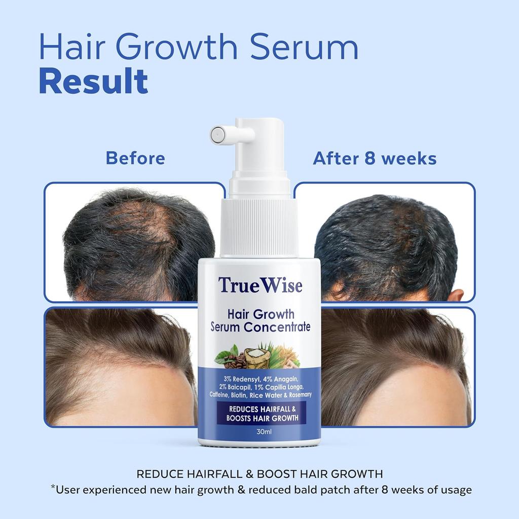 TrueWise Hair Growth Serum 30ml With Anagain Redensyl Baicapil Capilia Longa Biotin Caffeine For Thicker Hair