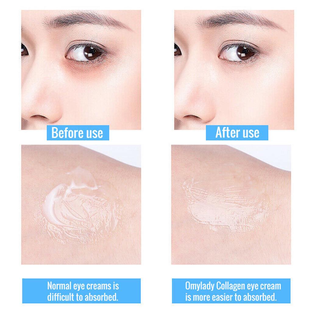 Buy 3pc OMY LADY AgeDefying Anti Wrinkle Eye Serum Cream Reduce Bag