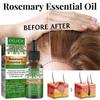 3pcs 30ML Hair Care Essential Oil Rosemary Smoothing Essential Oil Quick Hair Growth Care Essential Oil Anti-hair Loss Oil