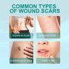 South Moon Scar Care Spray Smooth Skin Healing Reduce Burn Scars Pregnancy Marks