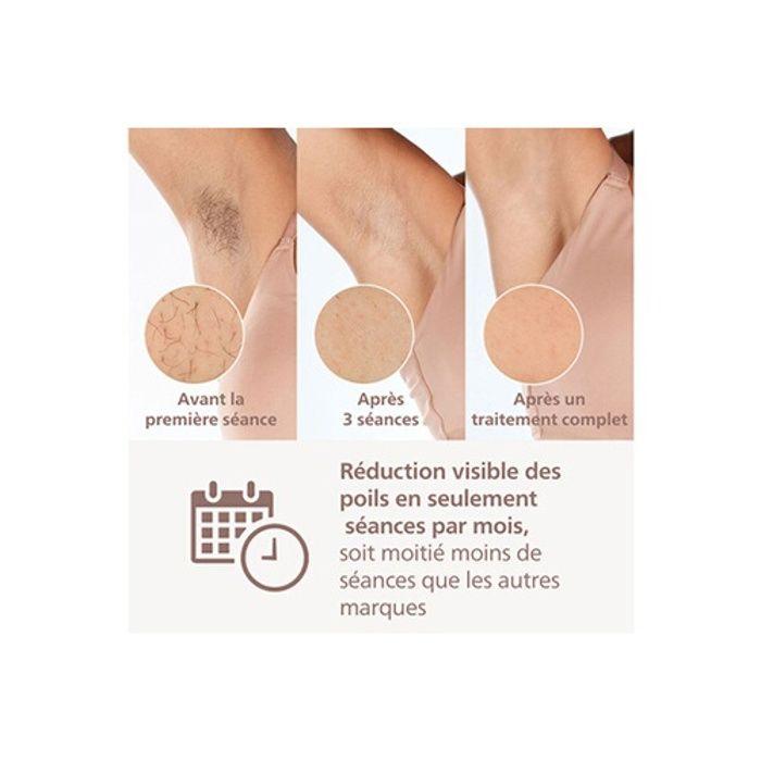 Epilation semi définitive philips bri949 00 epilateur a lumiere pulsee