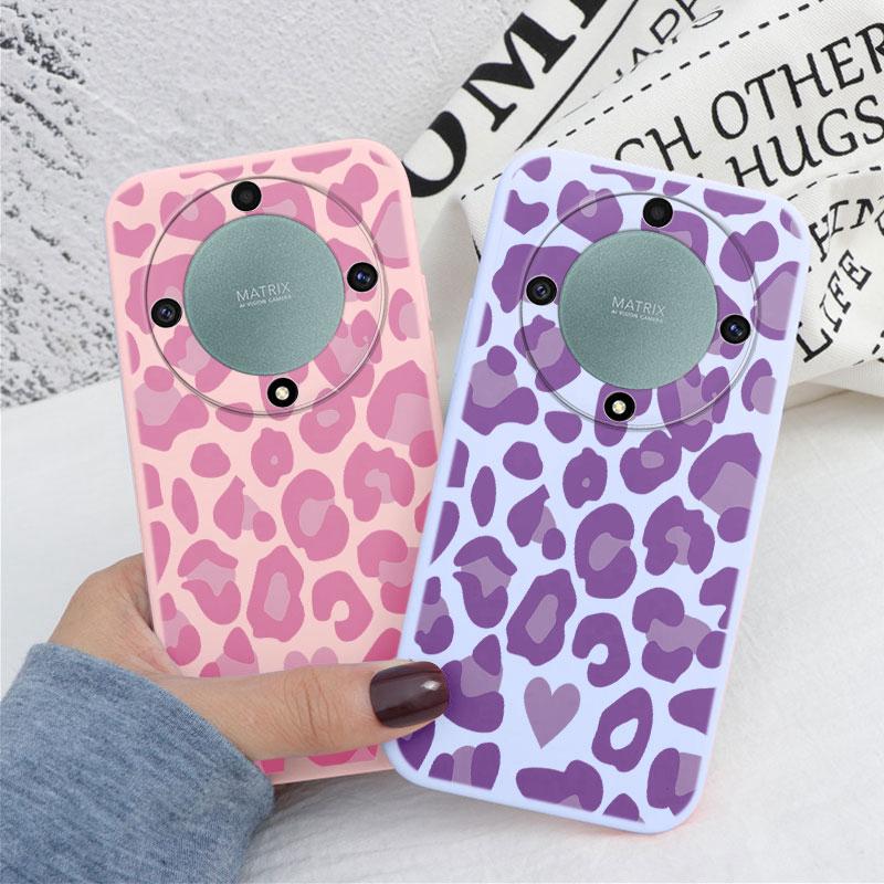 For Honor X9a X9b X9c Magic5 6 7 Lite 5G Case Fashion Leopard Print Back Cover Soft TPU Shockproof Funda Marble Texture Shell