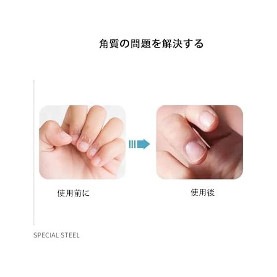Cuticle Nipper, Cuticle Treatment, Cuticle Cutter, Nipper, Nail Clipper, Cuticle Nipper, Nail Care, Cuticle Treatment, Cuticle Nipper, Suitable for