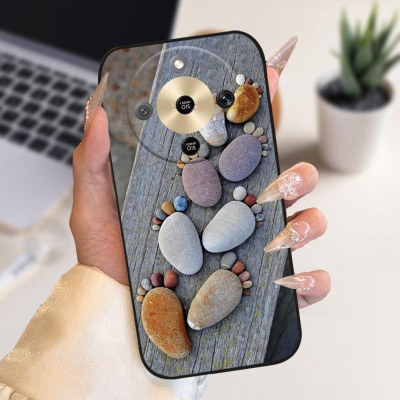 For Honor X9d Case X70 MTN-AN00 Stylish Cute Cartoon Cover Soft TPU Silicone Phone Case For Honor Magic 8 Magic8 X70 Fundas Capa