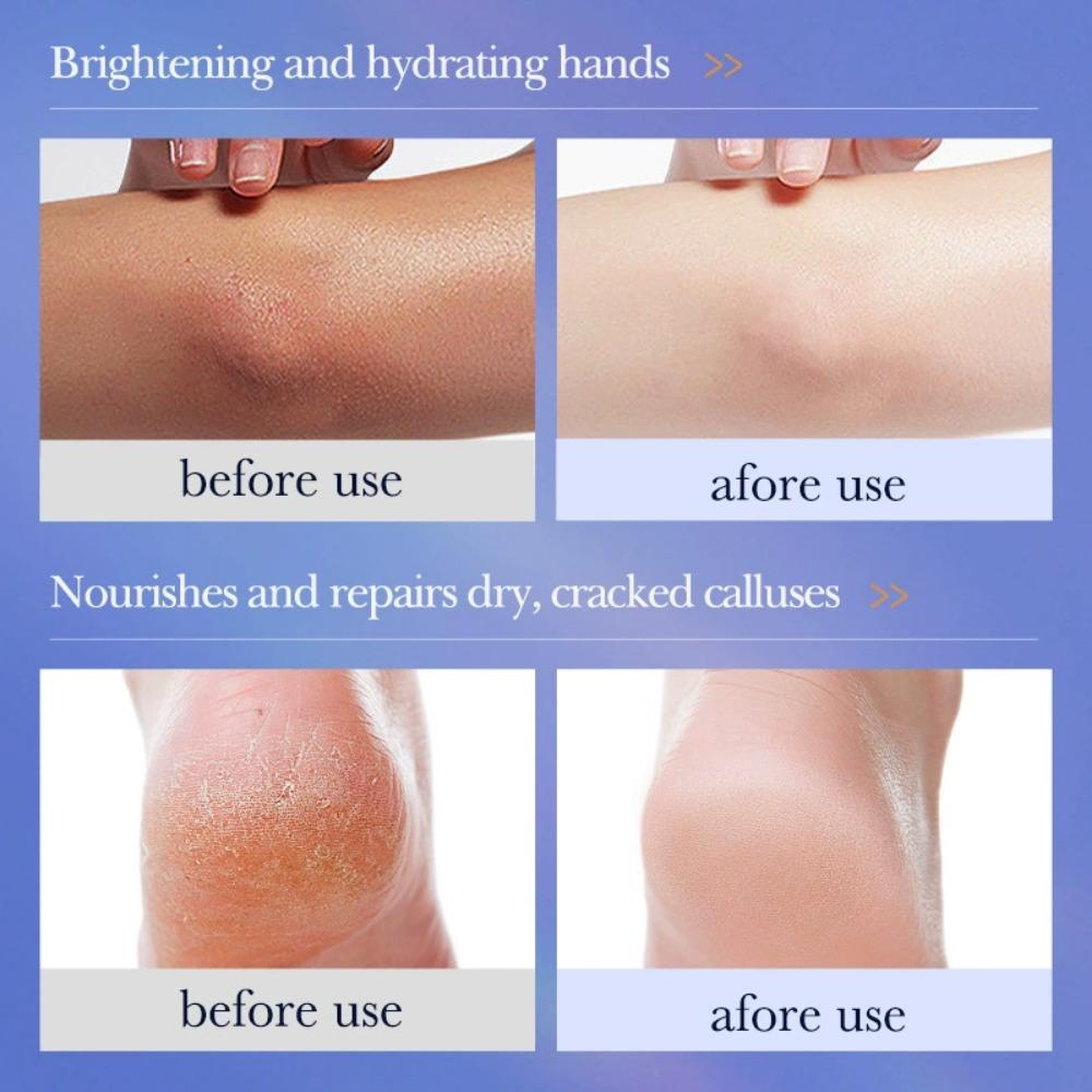 Repair Cream Vaseline Vitamin C Moisturizing Face Cream Moisturizes Skin