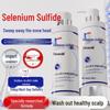 D7'S Selenium Sulfide Salicylic Acid Anti-Dandruff Shampoo