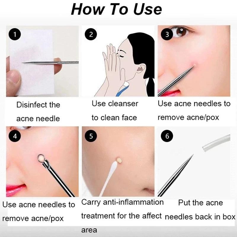 4PCS Blackhead Remover Acne Needle Tools Set Face Cleaning Black Dots Pimple Comedone Extractor Pore Cleaner Skin Care Products