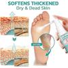 1-3PCS Professional Callus Remover Extra Strength Spray, Foot Callus Removal Spray, Instant Foot Peeling Spray Warding Off Foot