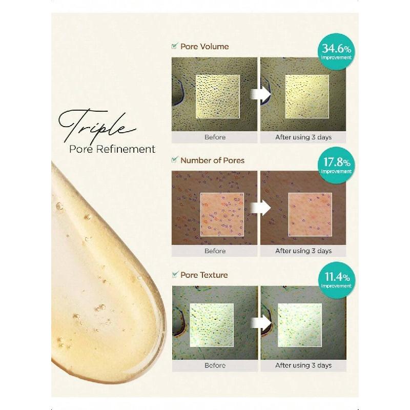 Acwell Lakris pH-balanserende Porensende Gel Skum 160ml - Mild, Hypoallergenisk Ansiktsrens For Klar, Glatt Hud