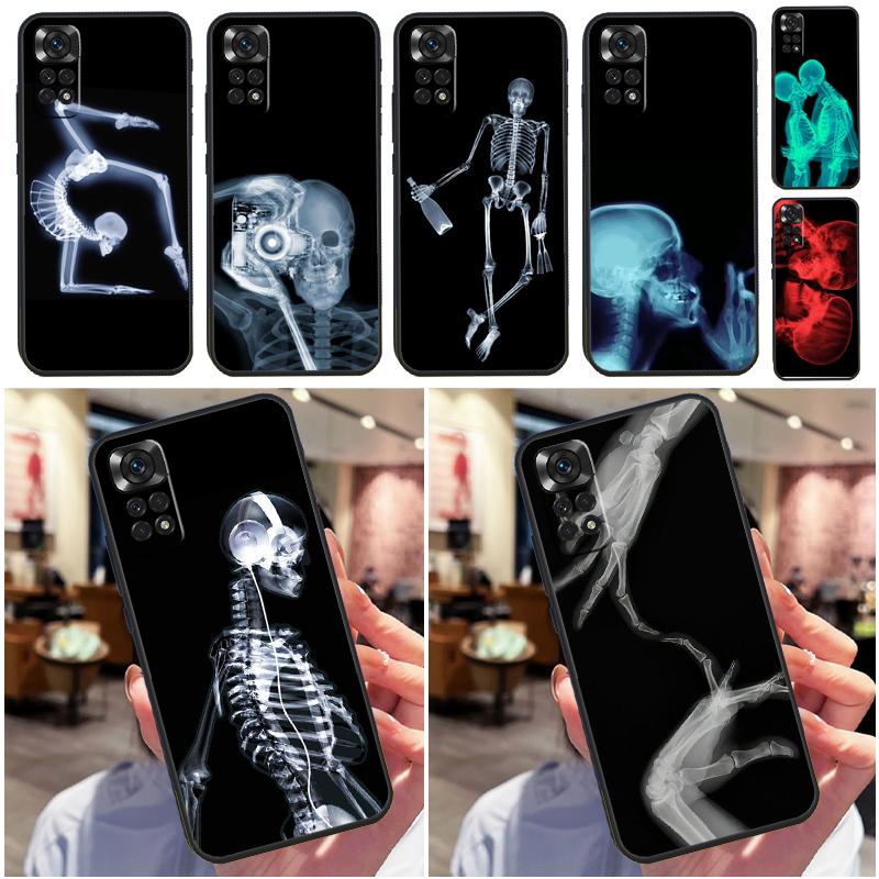 Xray Art Aesthetic Skull Funda For Xiaomi Redmi Note 14 13 Pro 9 10 11 12 9S 10S 11S 12S Redmi 13C 10C 12C 14C Case
