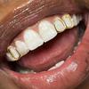 1 sada zubních Grillz šperků duté srdíčkové rovnátka Hip-Hop minimalistické dentální doplňky pro každodenní nošení party make-up