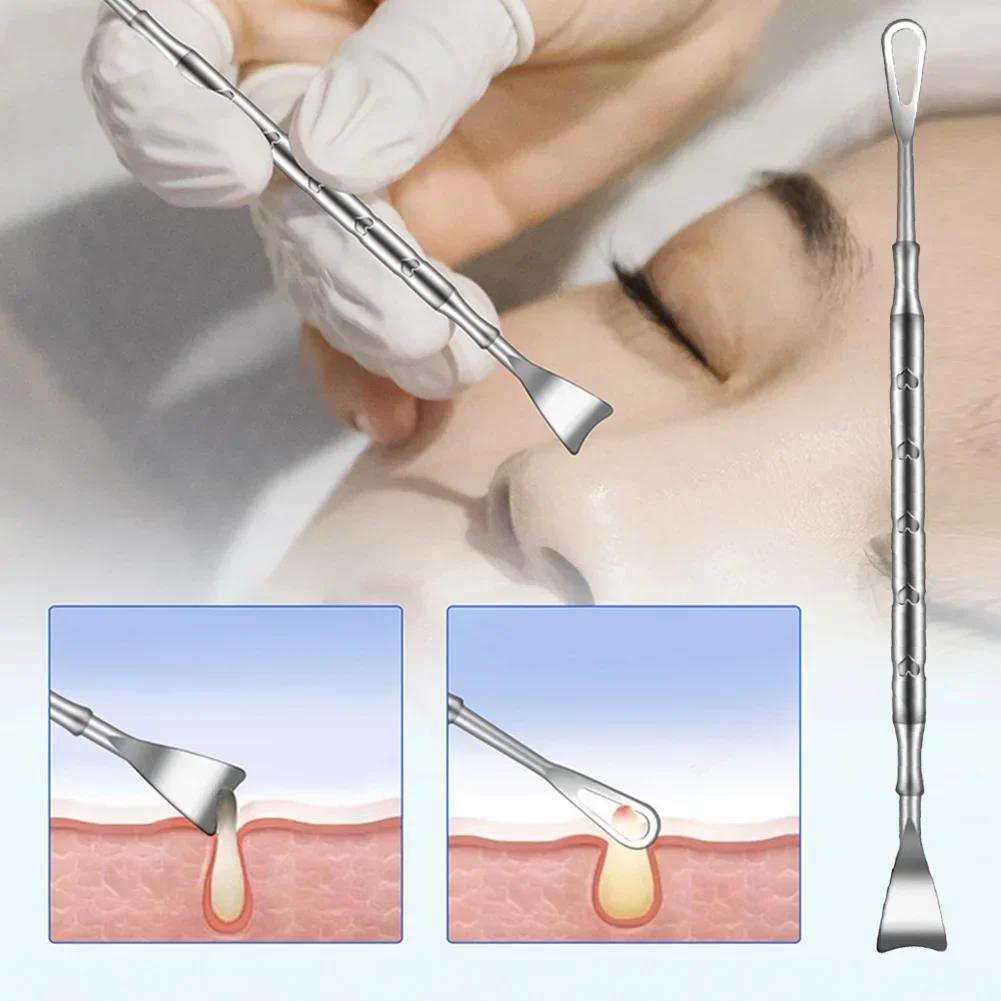 1pc Blackhead Remover Kit, Pimple Popper Acne Comedone Tool Set, Stainless Steel Extractor for Nose & Face Blemish