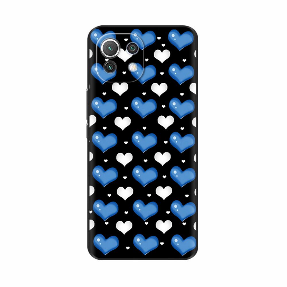 For Xiaomi Mi 11 Lite 5G NE Case Painted Soft Silicon Phone Back Cover For Xiomi Mi 11 Lite Case Mi 11 Lite Mi11 11i Shell Cover