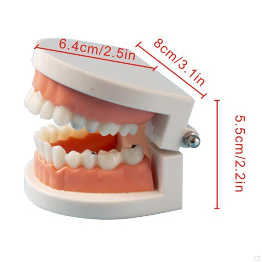 Sumulation Decay Teeth Model Study Teaching for Kids Teacher