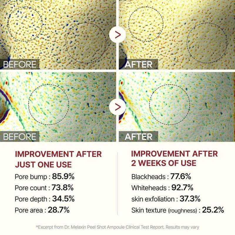 Dr.Melaxin Peel Shot Peeling Weiße Reiskapsel