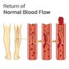 NIYANETAIL Vein Relief Patches – Varicose Veins & Swelling Relief | Improves Blood Circulation, Reduces Pain & Fatigue | Herbal Skin-Friendly Patc