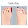Transparent Hammer Toe Pads - Pain Relief & Straightening Splint
