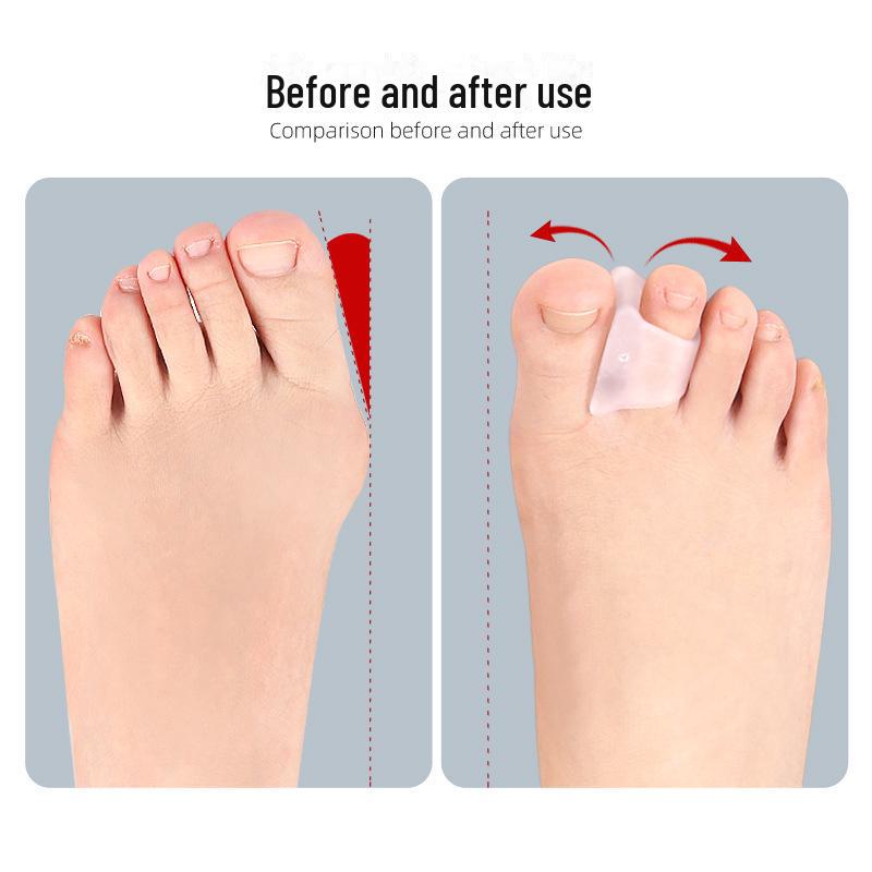 Transparent Hammer Toe Pads - Pain Relief & Straightening Splint