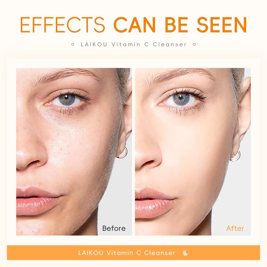 Laikou Vitamin C Hydrating Facial Cleanser - Moisturizes Skin & Cleans Pores.