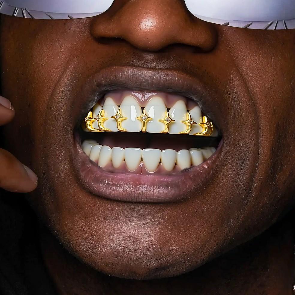 Stylish Star-shaped Zirconia Dental Braces: Single-row Openwork Gold Braces with a Star-shaped Chain, Adjustable Size