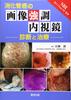 Image-enhanced Endoscopy for Diagnosis and Treatment of Gastrointestinal Cancer