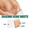 Scar Removal Gel Tape Self Adhesion Reusable Painless Scars Treatment Tapes for Hyperplastic Scars 59.1in