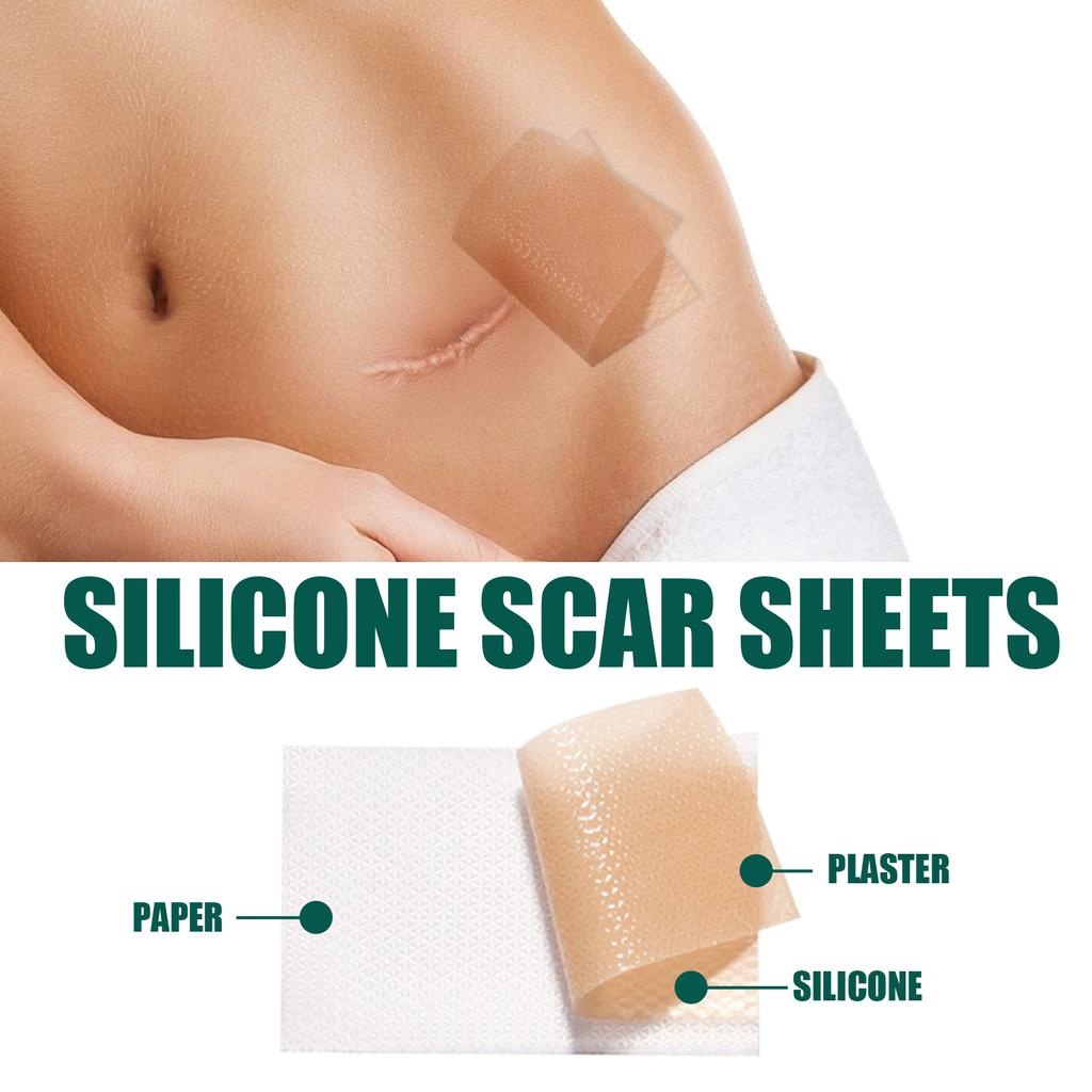 Scar Removal Gel Tape Self Adhesion Reusable Painless Scars Treatment Tapes for Hyperplastic Scars 59.1in