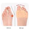 SEBS Gel Toe Spreader and Bunion Protector with Forefoot Insole and Big Toe Corrector