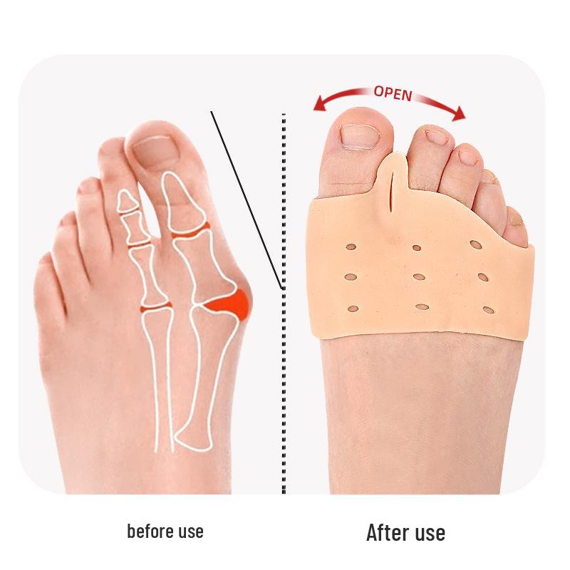 SEBS Gel Toe Spreader and Bunion Protector with Forefoot Insole and Big Toe Corrector