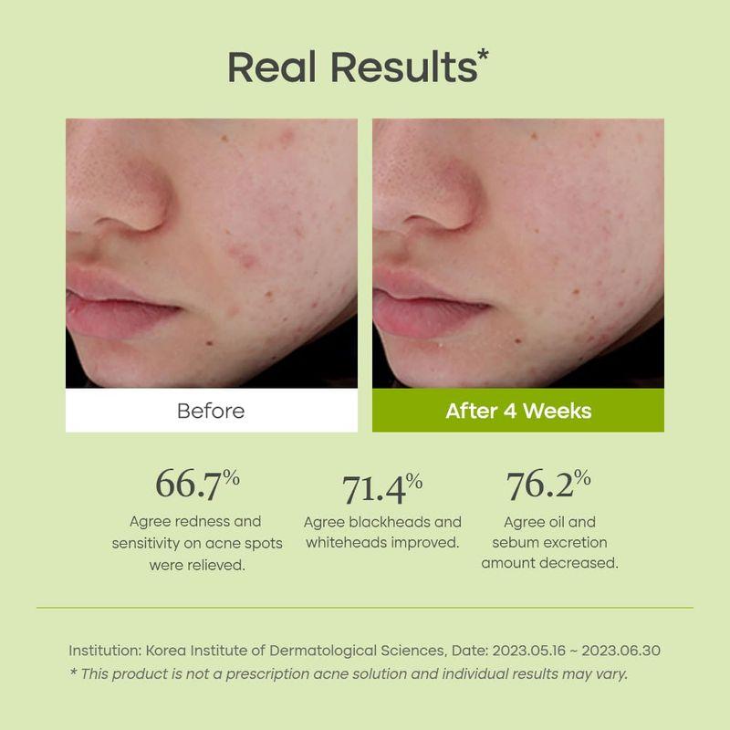 [Purito Seoul] Clear Code fruit Sérum 30ml